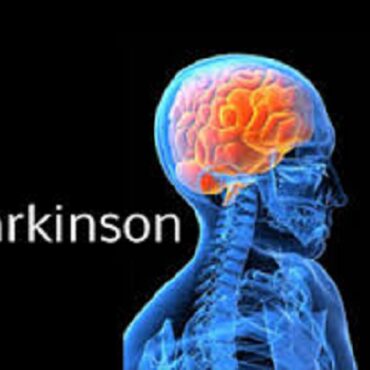 Sanità: nuove linee guida per i malati di Parkinson  Claudia Carzeri (FI): “Un lavoro intenso per migliorare la presa in carico e la continuità assistenziale”